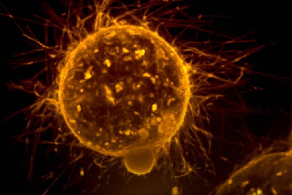 Célula arredondada iluminada em tons de laranja com múltiplas extensões finas irradiando ao redor, sobre fundo preto.